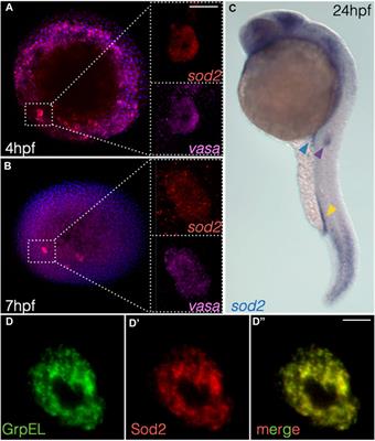 The mitochondrial protein Sod2 is important for the migration, maintenance, and fitness of germ cells